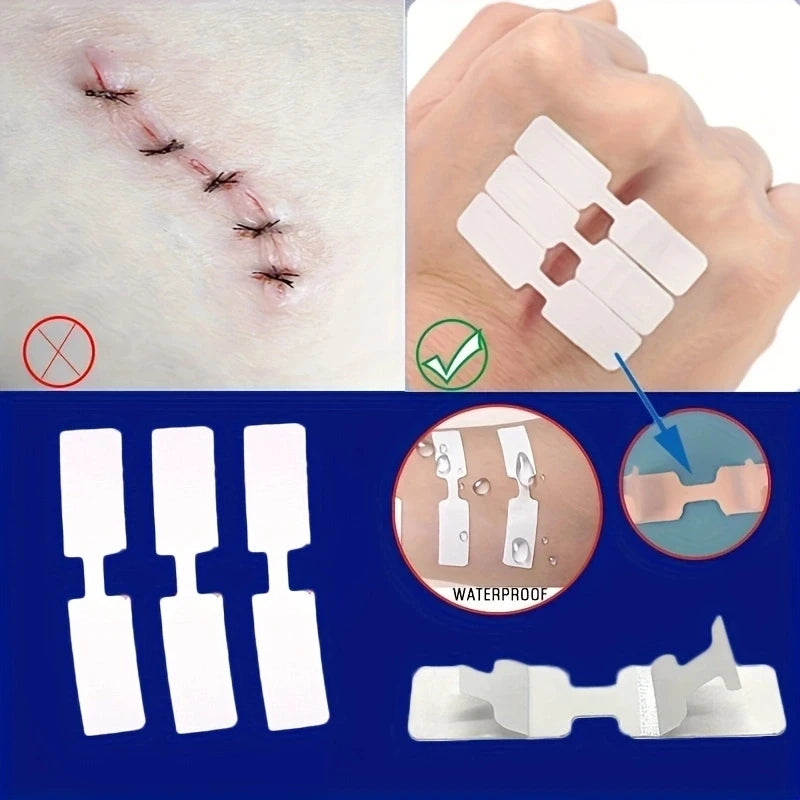 Wound Band Aid 5Pcs Outdoor Wound Adhesive Tape Disposable First Aid Wound Suture Patch