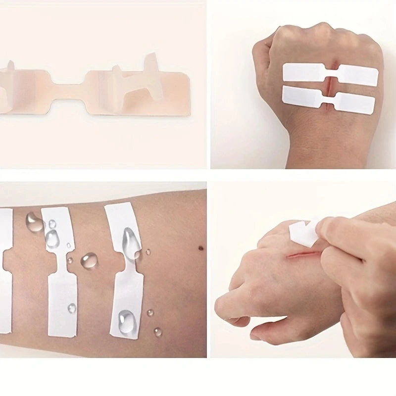 Wound Band Aid 5Pcs Outdoor Wound Adhesive Tape Disposable First Aid Wound Suture Patch